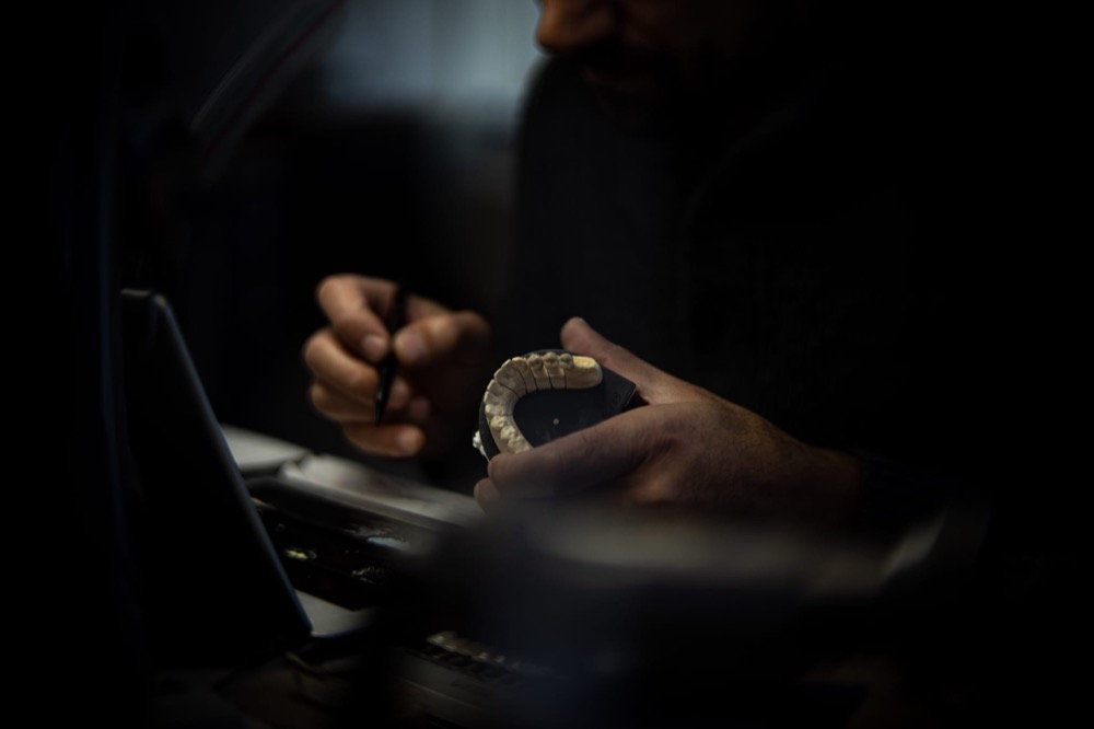Digitale Konstruktion am Bildschirm mit Kiefermodell