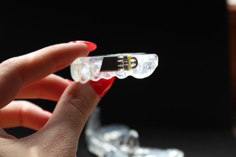Transparente Aufbissschiene in Detailansicht